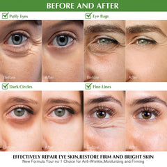 Empaque de Enaskin Naturals con parches para ojos té verde listo para uso.