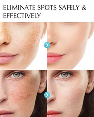 EnaSkin Serum iluminador, enfoque en manchas, ayuda a iluminar el rostro de forma suave.