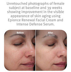 Crema de renovación facial Epionce, ingredientes clave para nutrición diaria de la piel.