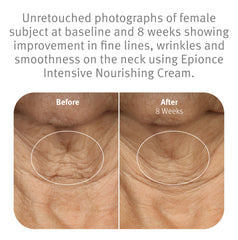 Ceramidas en la fórmula de Epionce para fortalecer la barrera cutánea