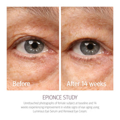 Epionce Renewal Eye Cream ayuda a suavizar líneas alrededor de los ojos.