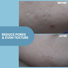 Niacinamida de Eva Naturals armoniza tono y textura