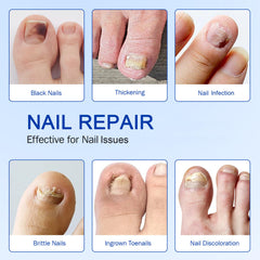 FANSHI patches highlighting reduced discoloration and smoother nail surface.