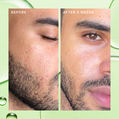 Exfoliación suave diaria gracias a enzimas de papaya para piel clara.