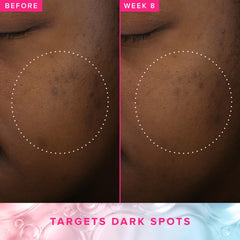 Farmacy tónico líquido 5% PHA y azelaico, textura suave para exfoliar.