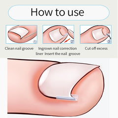 Fifuroes levantador de uñas: extracción delicada para una manicura en casa.