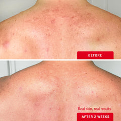 First Aid Beauty: aplicación fácil en áreas difíciles de alcanzar