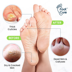 Foot Cure: sal de epsom para pie con relax y suavidad