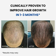 ForHair-appli-cuir-chevelu : application ciblée sur le cuir chevelu, sans résidu gras.