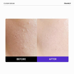FRANKLY Closer Serum textura gel suave al aplicar