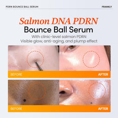 FRANKLY Salmon PDRN Bounce Ball Serum, frasco compacto para uso diario