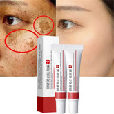 Fupah crema blanqueadora para manchas faciales, tono más uniforme.