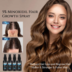 FUZYAT Minoxidil uso multifuncional para barba y cabello.