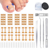 Generic corrector de uñas encarnadas: kit completo para cuidado en casa