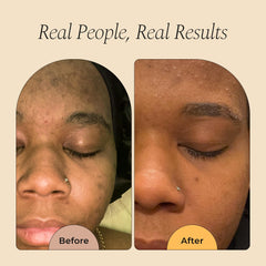 Glo Melanin-jabon-curcuma-cuerpo: limpieza suave para rostro y cuerpo.