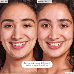 Aplicación nocturna de Glow Recipe en rostro: calma piel sensible
