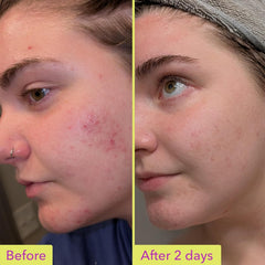 Good Molecules CICA-exosome cream jar, soothing texture preview for calm, balanced skin