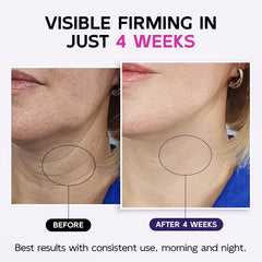 GOOSURE crema cuello: textura suave que apoya hidratación profunda