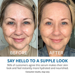 goPure Sérum Hyaluronique aloe vera, confort et douceur immédiats