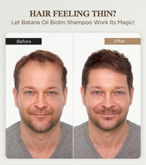 GOWILOVE Shampoing Biotine, ingrédients naturels pour nourrir les cheveux dès la racine.