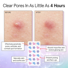 Parche azul en forma de nube Grace & Stella para uso nocturno