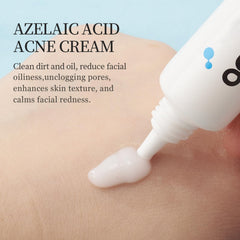 Textura ligera Grospe crema azelaico 20% para uso diario.