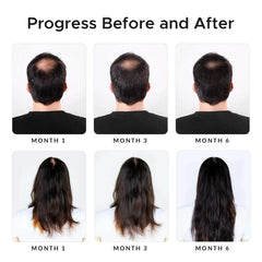Growth Essence té verde y romero, antioxidantes para un cabello más sano.