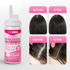 Hair Regen Minoxidil Foam for Women shows quick-absorbing foam texture.