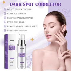 HANYWIL crema iluminadora para hiperpigmentación, mejora la uniformidad de la piel.