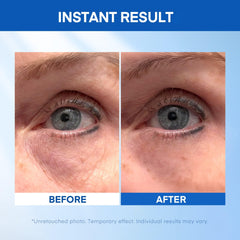 HealthyDerm levantamiento instantáneo para ojos ojos hinchados reducidos