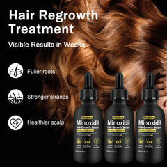 Hosioe Minoxidil para barba estimula crecimiento y densidad.