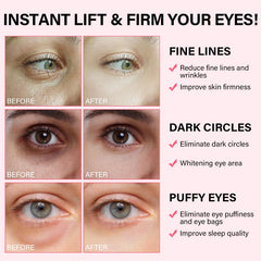 iMethod PDRN Parches Ojos Antiarrugas suavizan líneas finas