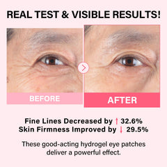 iMethod PDRN Parches Ojos Refrescantes reducen hinchazón y despiertan la mirada