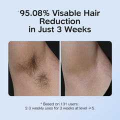 INNZA IPL 9-niveles-energia: ajuste para zonas grandes y sensibles.