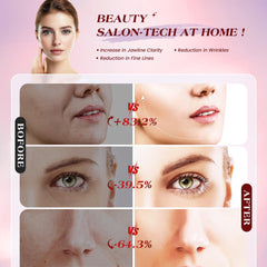 INTEO Microcurren Facial Device focuses on face and neck for targeted toning