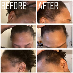 IQNATURAL cuidado capilar desde la raíz para cabello dañado.