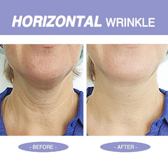Irismistx crema cuello: fórmula con retinol y hialuronico para suavizar arrugas
