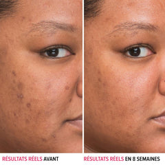 Aplicación diaria en la piel: 4-5 gotas para rostro y cuello.