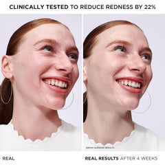 IT Cosmetics Bye Bye Redness Serum, cuidado diario, hidratación de 24 horas para piel sensible