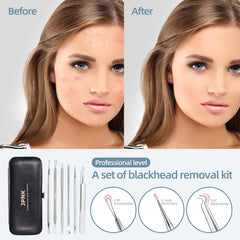 JPNK herramientas de acero inoxidable: duraderas para eliminar imperfecciones con control.