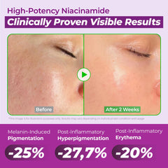 JUMISO Niacinamide 20% sérum réduit l'apparence des pores et la texture peau.