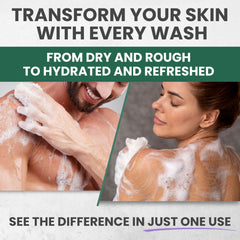 Aplicacion en mano de Kesmedik gel ducha, limpieza diaria para piel equilibrada.