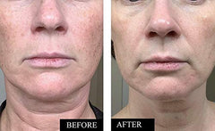 Kleem Organics Serum Vitamina C: gotero para aplicación precisa y suave.
