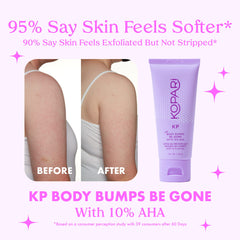 Kopari KP Body Bumps Be Gone: textura exfoliante con cocos visibles.