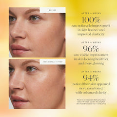 KORA Organics Noni Glow, aceite rosa mosqueta para nutrición facial.
