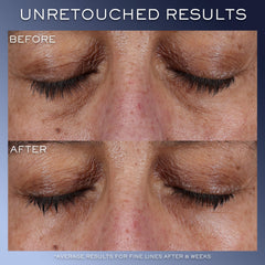 Lancôme Génifique Contorno de Ojos, reducción visual de arrugas suaves alrededor de los ojos.