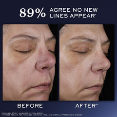 Lancôme Génifique Recuperación Suero, aplicación fácil en manos y rostro.