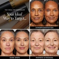 Correction des cernes et imperfections avec Ideal Fix.