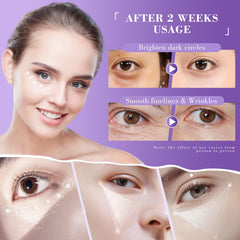 Lenaale contorno de ojos con retinol para posibles mejoras en la textura.