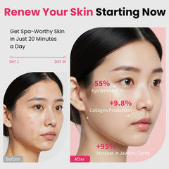 Magivol Face Lift 8 en 1, LED rouge pour lisser les contours et raffermir.
